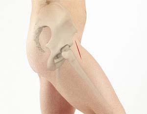 Direct Anterior Approach Hip Replacement Layton, Bountiful, Ogden, Salt  Lake City, Utah